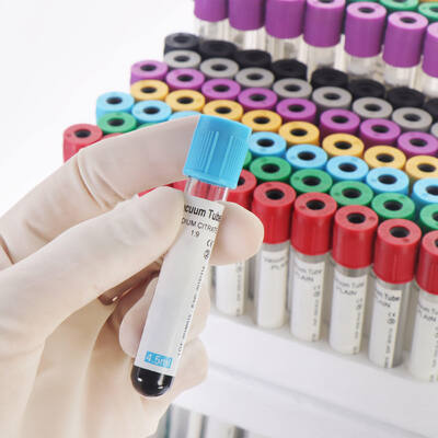شراء أنابيب الدم EDTA الفراغية لعدد الدم الكامل (CBC) التصنيع عبر الإنترنت